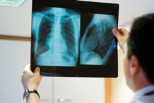 Radiologue et radio des poumons