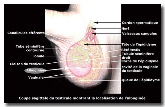 Pathologie des testicules et des bourses : varicocèle, tumeurs